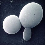 Why Candida Infections Reoccur — Candida Spores